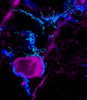Mikroglia-idegsejt kapcsolat az agyban