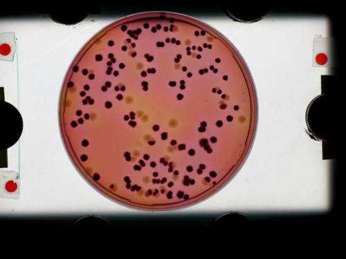 E-coli-baktérium