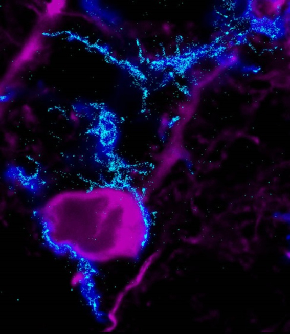 Microglia-neuron interactions in the brain