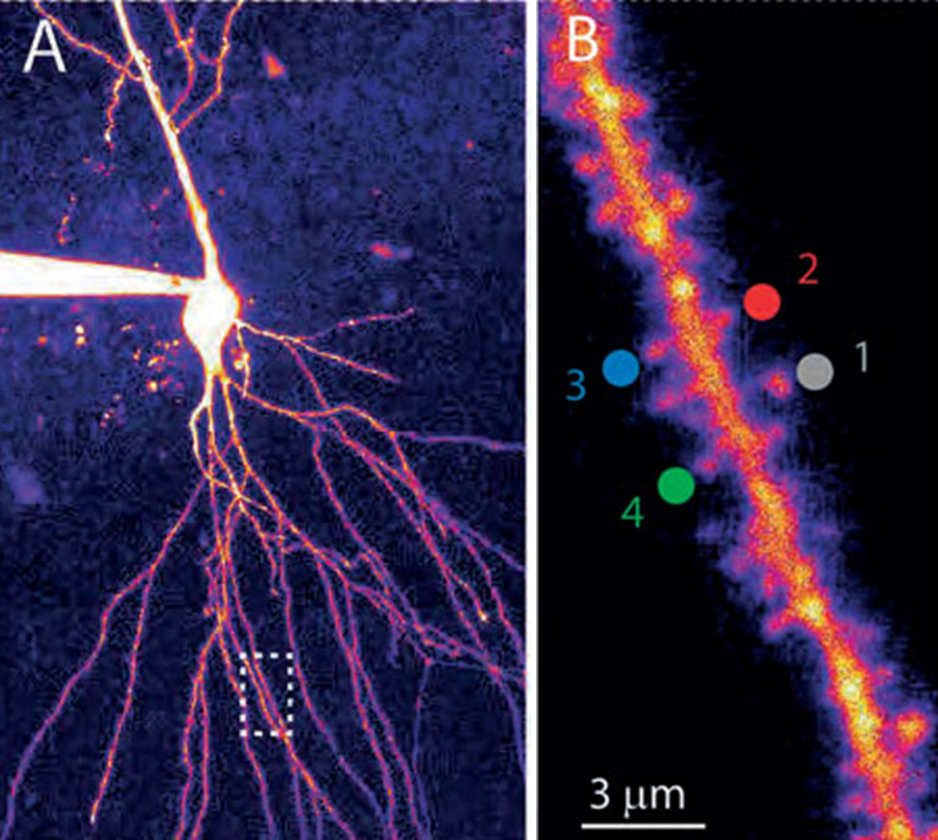 Fluoreszcens festékkel láthatóvá tett idegsejt